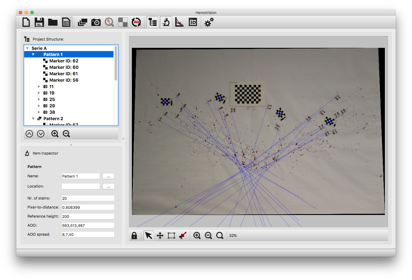 HemoVision Automated Impact Pattern Analysis